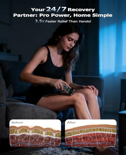 R1 Mini Therapy Massager - Travel Deep Tissue Vibration Massage Gun - view 5