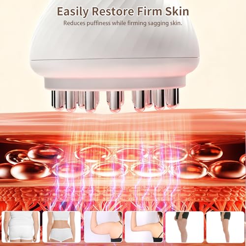 Body Sculpting Machine, Lymphatic Drainage Massager & Anti Cellulite Massage Tool, Helps Reduce Stretch Marks & Cellulite, Pain Relief Devices for Legs, Arms & Belly, Body (White) - view 5