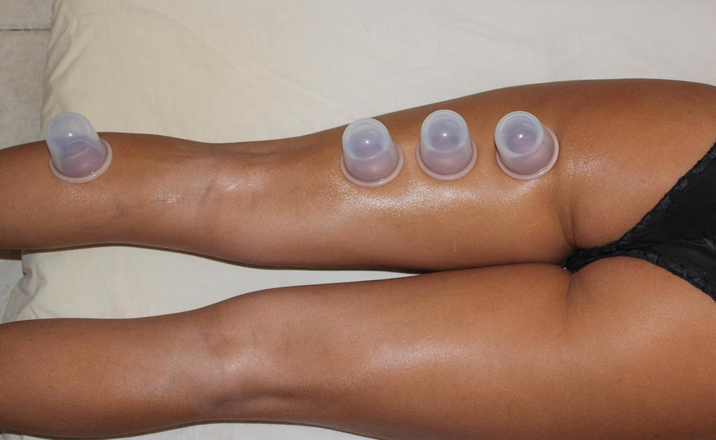 Silicone cupping set, 6 massage cups, 2 sizes, for pain relief | massage therapy cups for arthritis and pain relief, anti-aging and cellulite; cupping kit for relaxation and muscle recovery - view 8